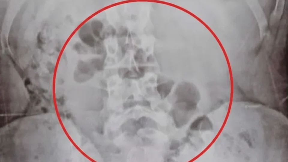 Foto: Wanderson Caldeira