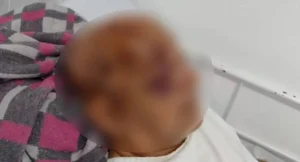 Idoso de 71 anos é agredido pelo próprio filho em área rural de Vilhena (RO)