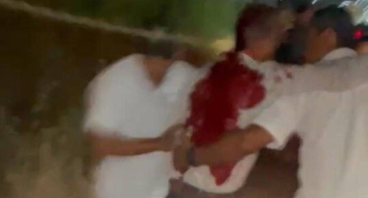 Fundador da Expoaja é atingido por tiro na cabeça em festa