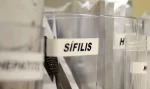 Sífilis continua em ritmo acelerado de crescimento no país