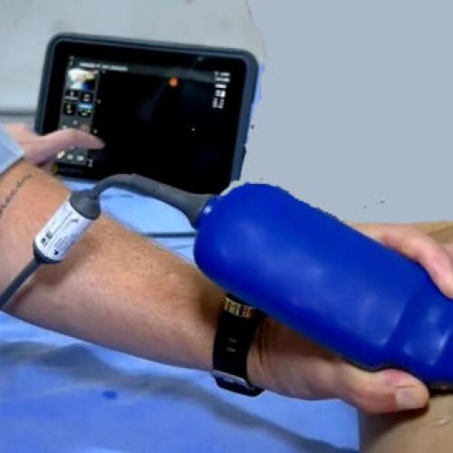 Equipamentos com tecnologia de IA agilizam exames no Pronto-Socorro João Paulo II, em Porto Velho