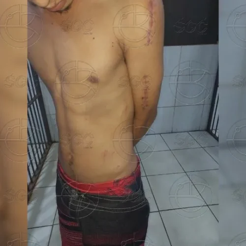 Criminoso é espancado por populares após agredir adolescente durante tentativa de roubo