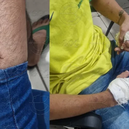 Jovem é esfaqueado pela esposa após discussão em residencial na zona Leste