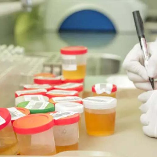 Rondônia tem 447 laboratórios e 4 falhas em análises, aponta ANVISA