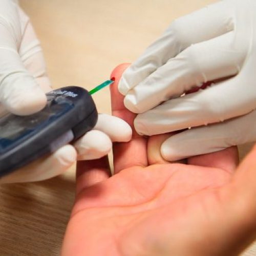 Ações de prevenção e orientação sobre a saúde dos rins serão realizadas nesta sexta-feira, 13, em Porto Velho