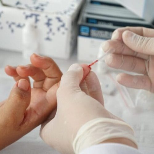 Importância da conscientização é massificada durante campanha de alerta às hepatites virais