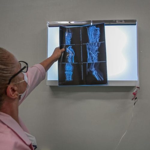 Redução nos atendimentos de saúde por acidentes de trânsito reflete ações integradas do governo de RO