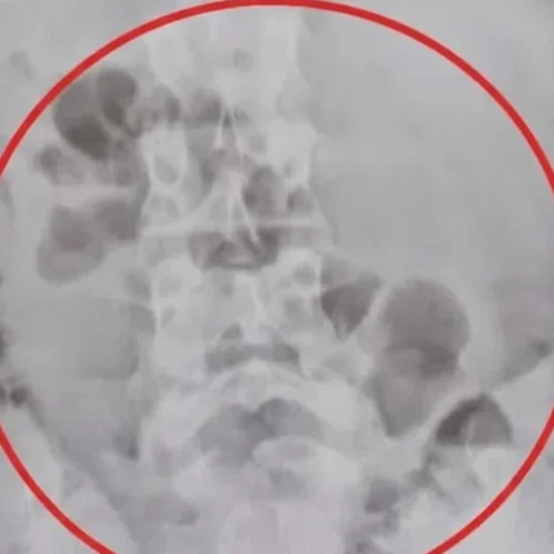 Foto: Wanderson Caldeira