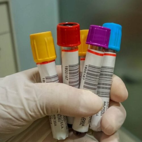 Ações de vigilância aos sintomas da febre oropouche são intensificadas pelo governo de RO