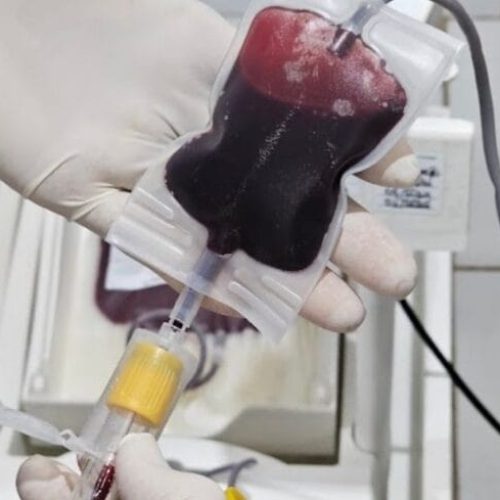 Fhemeron reforça doação de medula óssea que é vital para o tratamento de mais de 50 doenças hematológicas