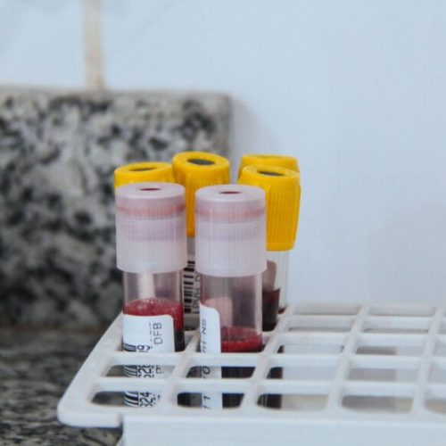 Governo de RO intensifica campanhas de doação de sangue para salvar vidas