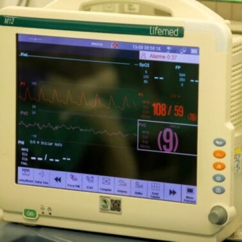 Conscientização e prevenção contra o Acidente Vascular Cerebral em Rondônia são destacados pela Sesau