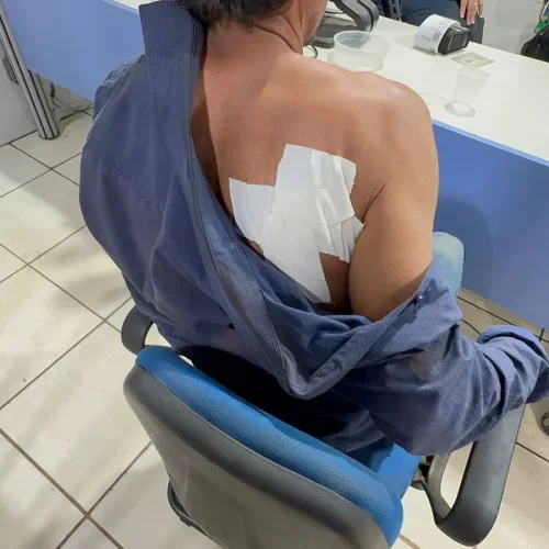 Homem é estaqueado após se negar a comprar cerveja para suspeito em Porto Velho