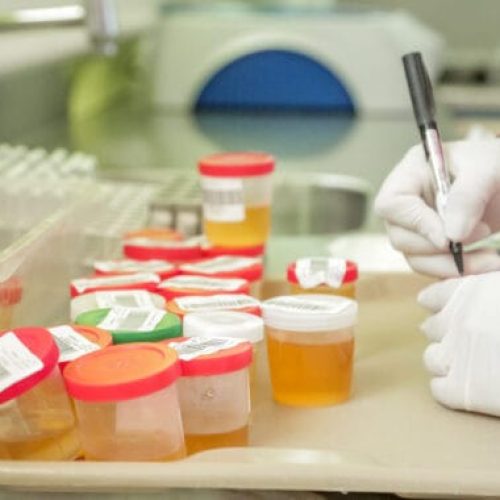 Pesquisas sobre doenças tropicais são ampliadas no estado pelo governo de RO