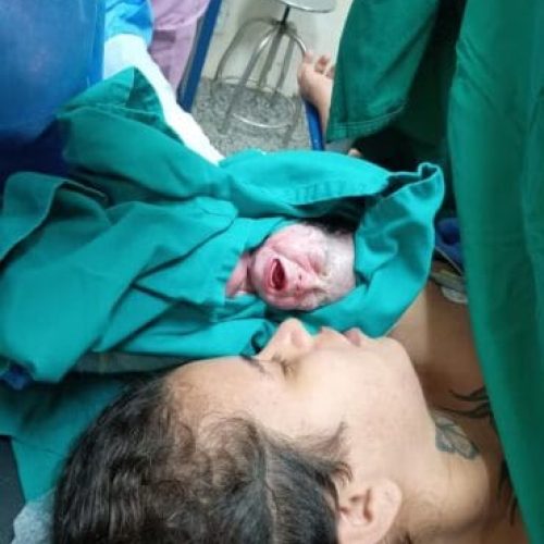 Parto raro de trigêmeas univitelinas é realizado na nova maternidade do Hospital de Base, em Porto Velho