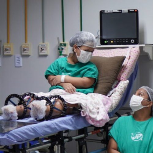 Tratamento inédito para nanismo na região Norte é realizado com investimentos do governo de RO