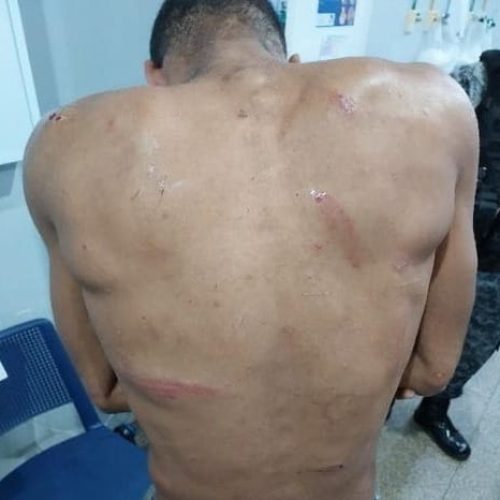 Ladrão cai do telhado e é dominado por moradores ao tentar roubar 700 metros de fio