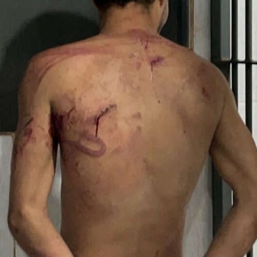 Criminoso é espancado após atacar barbeiro a facadas na zona sul