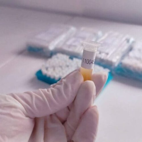 Inquéritos epidemiológicos sobre prevalência de brucelose e tuberculose bovina avançam para fase final