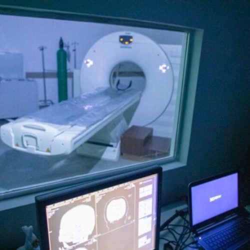 Governo de RO avança na redução das filas de espera para exames de tomografia e ressonância magnética no estado