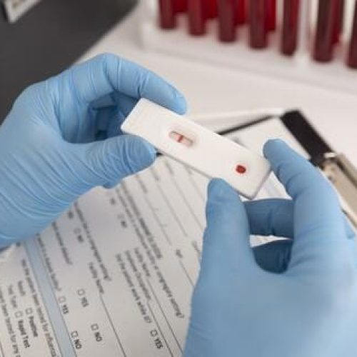 Covid-19 continua em crescimento e expansão pelo país