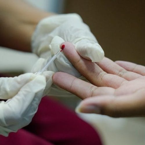 Campanha Julho Amarelo alerta para o combate às hepatites virais na capital