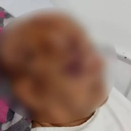 Idoso de 71 anos é agredido pelo próprio filho em área rural de Vilhena (RO)