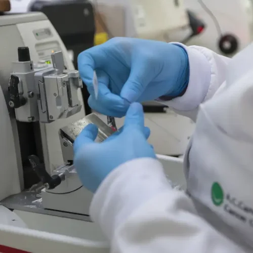 NOVEMBRO AZUL: Cura de câncer de próstata pode chegar a até 98%