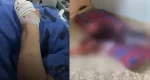 Mulher é ferida a facada por ex-marido que comete tentativa de suicídio em RO
