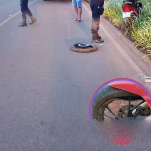 Pai sofre fratura exposta na RO-479 ao cair em buraco enquanto socorria o filho