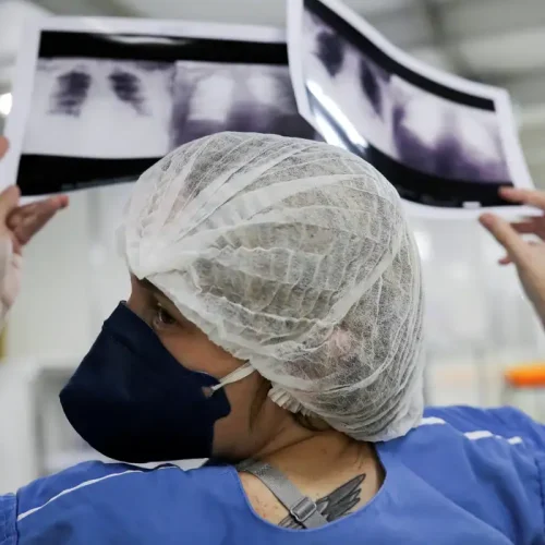 Câncer de pulmão: 15% dos casos acontecem em não fumantes